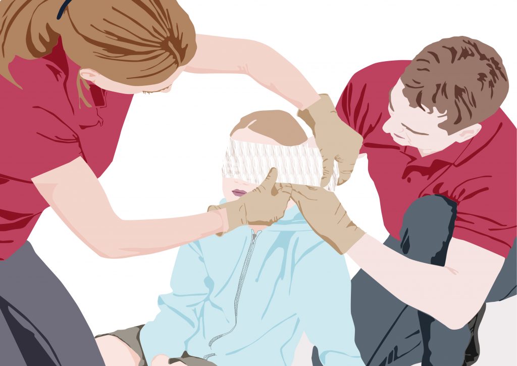 Auge Verätzung was tun?