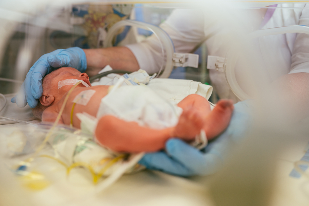 Three-day-old,Newborn,Baby,In,Intensive,Care,Unit,In,A,Medical