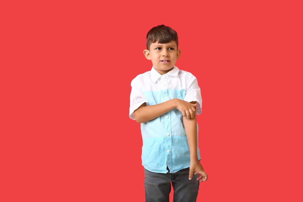 Welt-Neurodermitis-Tag: Therapieoptionen für Kinder und Jugendliche © Shutterstock